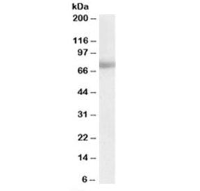 MTA1 Antibody