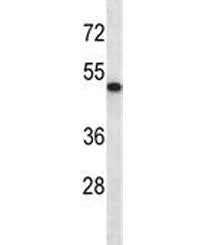 ABI2 Antibody