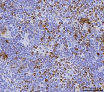 IHC staining of FFPE mouse spleen tissue with Cdc25b antibody. HIER: boil tissue sections in pH8 EDT