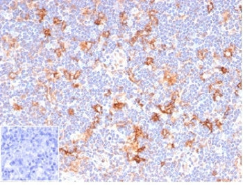 IHC staining of FFPE human lymph node tissue with recombinant CD86 antibody (clone C86/6500R). Negat