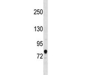 ACSL3 Antibody / FACL3