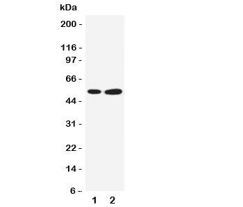 SBP Antibody Selenium Binding Protein