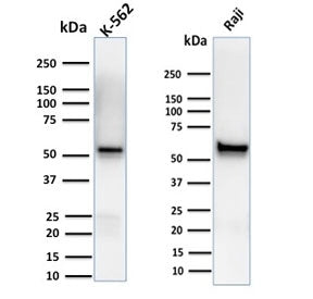 Western blot testing of human K562 and Raji cell lysate with Spastin antibody (clone Sp 6C6). Expect