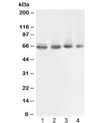 Western blot testing of 1) rat muscle, 2) human COLO320, 3) human 22RV1 and 4) human PANC lysate wit