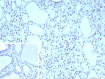 IHC staining of FFPE human thyroid tissue with NKX2.1 antibody (clone NX2.1/9031). Inset: PBS used i