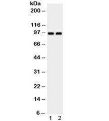 Western blot testing of 1) rat brain and 2) mouse liver lysate with AHR antibody. Expected/observed 
