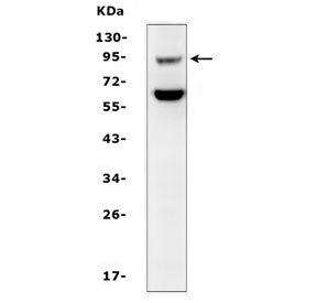 SLC9A2 Antibody