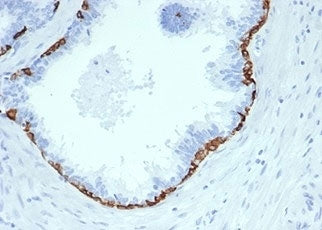 IHC staining of FFPE human prostate tissue with Cytokeratin 14 antibody (clone KRT14/4584R). HIER: b