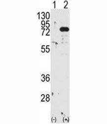 PKC beta Antibody