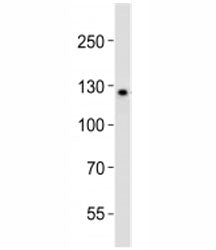 Western blot analysis of lysate from K562 cell line using LIFR antibody diluted at 1:1000. Expected/