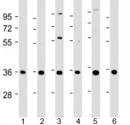 NT5C3 Antibody / Cytosolic 5\'-nucleotidase 3A
