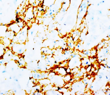 Tenascin Antibody
