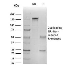 SDS-PAGE analysis of purified, BSA-free IL1B antibody (clone IL1B/465) as confirmation of integrity 
