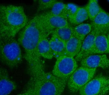 Immunofluorescent staining of FFPE human A431 cells with SSH3BP1 antibody (green) and DAPI nuclear s