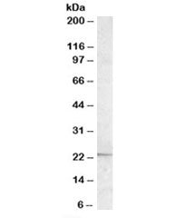 Western blot testing of Daudi lysate with APOBEC3C antibody at 0.5ug/ml. Predicted molecular weight: