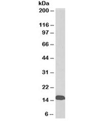 TTR Antibody