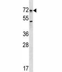 Bmpr1a Antibody