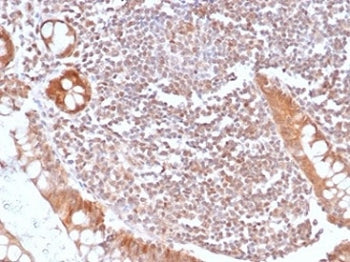IHC staining of FFPE human small intestine with recombinant SMAD4 antibody (clone SMAD4/6309R). HIER