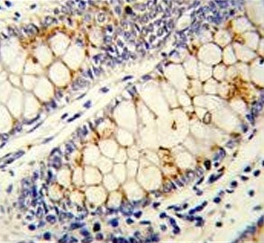 SRSF1 Antibody / SF2