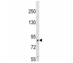 Western blot analysis of TrkA antibody and HepG2 lysate. Observed molecular weight: 85~140 kDa depen