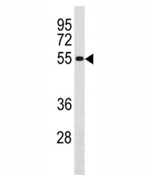 Cyclin B1 Antibody (CCNB1)