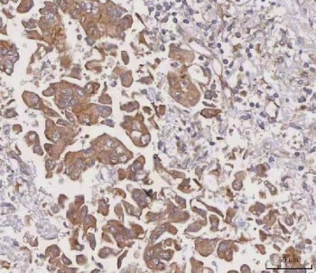 MGAT3 Antibody
