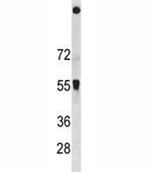 SQSTM1 Antibody (p62)