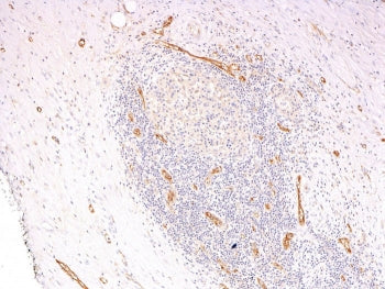 IHC: Formalin-fixed, paraffin-embedded human pancreas stained with vWF antibody cocktail (clones 3E2