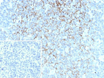 IHC staining of FFPE human tonsil. Membrane stained using FCER2/6893 at 2ug/ml. Inset: PBS used in p
