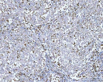 CD14 Antibody