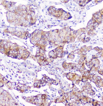 CD2AP Antibody