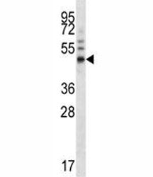 FOXA1 Antibody