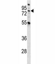 MST1 Antibody (Hepatocyte growth factor-like protein)