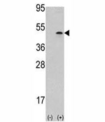 Aurora B Antibody