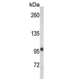 VPS53 Antibody