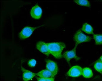 Immunofluorescent staining of FFPE human Caco-2 cells with MKK3 antibody (green) and DAPI nuclear st