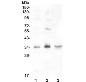 Western blot testing of 1) rat testis, 2) rat PC-12 and 3) mouse testis lysate with FGF23 antibody a