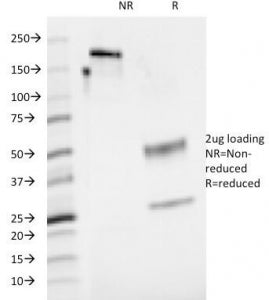 CD48 Antibody (Pan Leukocyte Marker)