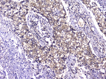 TCP1 alpha Antibody