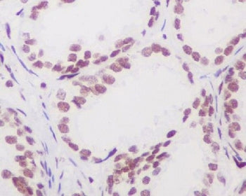 IHC staining of FFPE human prostate tissue with Androgen Receptor antibody. HIER: boil tissue sectio