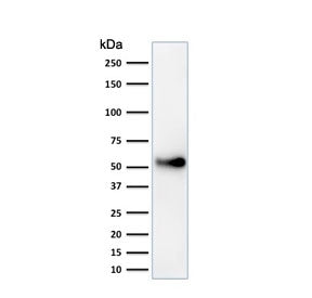 p53 Antibody / TP53