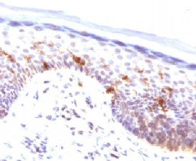 CD1a Antibody