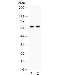 Western blot testing of human 1) 22RV1 and 2) 293 cell lysate with FZD1 antibody. Predicted/observed