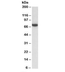 Western blot testing of Jurkat lysate with ZAP70 antibody at 0.3ug/ml. Predicted/observed molecular 