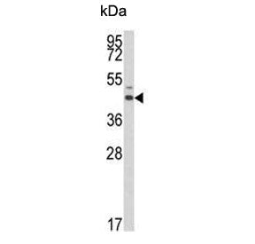ESRRA Antibody / Estrogen-Related Receptor Alpha
