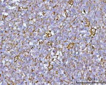 IHC staining of FFPE human tonsil tissue with RUFY4 antibody. HIER: boil tissue sections in pH8 EDTA