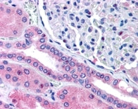 Rhophilin 2 Antibody