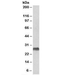 HLA-DQA2 Antibody
