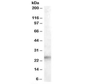 IGFBP6 Antibody