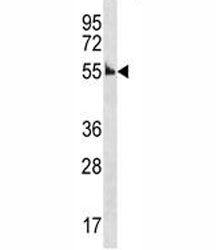 Cyclin A Antibody (Ccna1)